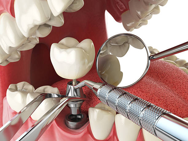 Best Emergency Denture Repair in Bentonville, AR
