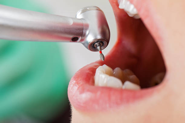 Best Broken or Chipped Tooth Repair in Bentonville, AR